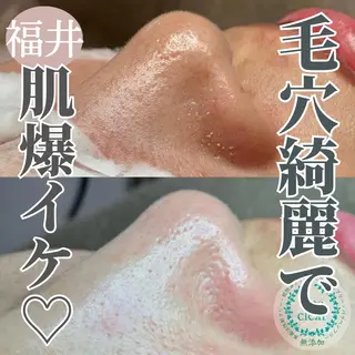 毛穴ケア専門サロン Yourmeユアミーのエステ・リラクイメージ