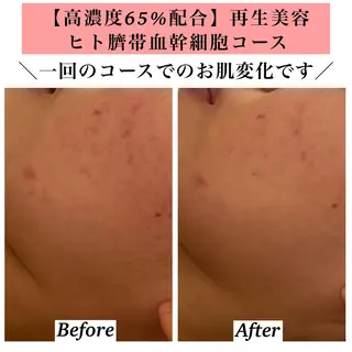 Bellesthe (ベルエステ)のエステ・リラクイメージ