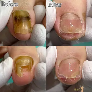 東京巻き爪アカデミー所属・東京巻き爪 アカデミーのエステ・リラクイメージ