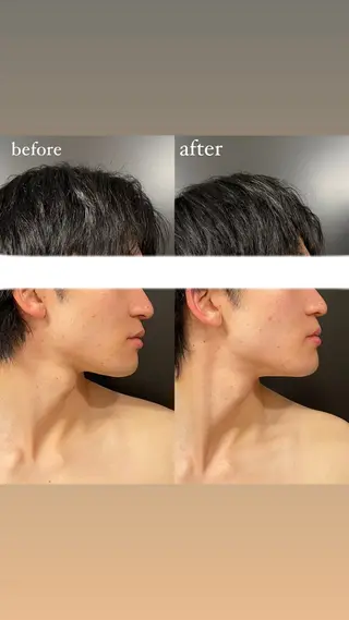 エステサロンino.colore'所属・小顔サロン ino.coloreのエステ・リラクイメージ