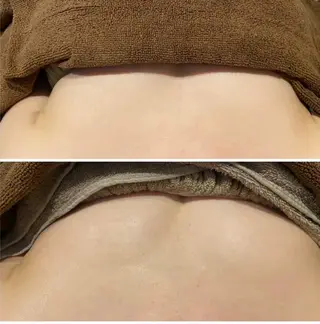 南森町・肌質改善 BELMIMARのエステ・リラクイメージ