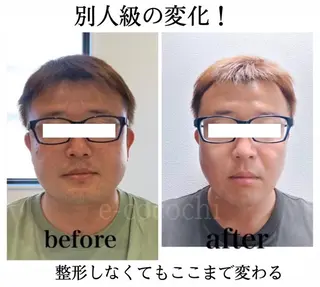 小顔と ヘッドスパのお店のエステ・リラクイメージ