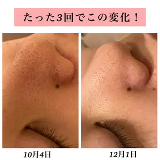 Bellesthe (ベルエステ)のエステ・リラクイメージ