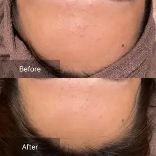 産毛専門店 Bittoのエステ・リラクイメージ