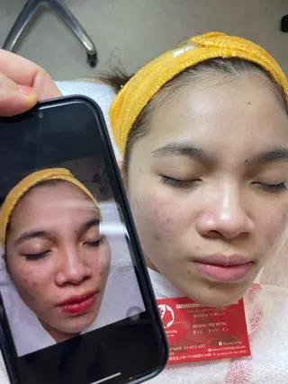 ニキビ、痩身、脱毛、 サクラチャンスパのエステ・リラクイメージ