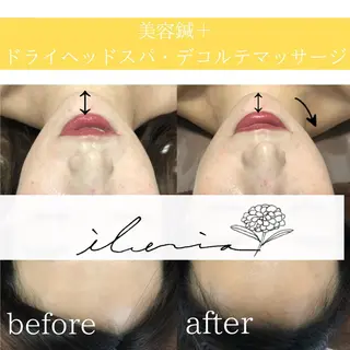 心斎橋痩身ダイエット 韓国.美容鍼.小顔のエステ・リラクイメージ