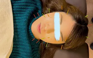 【鍼灸サロン にった】所属・はりきゅう整体 新田鍼灸院のエステ・リラクイメージ