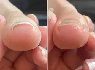 ネイル Ree所属・ネイル脱毛 Reeのネイルデザイン