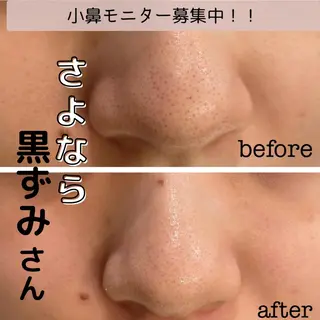 DeI'm   名古屋栄所属・小林 玲菜のエステ・リラクイメージ