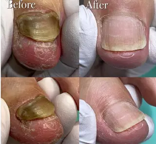 ネイル サンキューフット浦和店所属・サンキューフット 浦和店のエステ・リラクイメージ