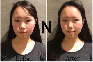 目黒/小顔/矯正 美容整体師テツロウのエステ・リラクイメージ