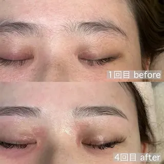 アイブロウ アイブロウ&フェイシャルサロンa‘lm所属・WAX脱毛/肌質改善 眉毛とお肌のサロンのエステ・リラクイメージ