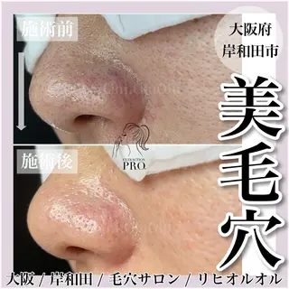 毛穴汚れ改善専門店/ 岸和田/リヒオルオルのエステ・リラクイメージ