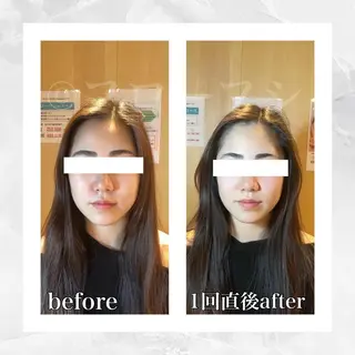 部分痩せ♥️小顔専門 MIKUのエステ・リラクイメージ