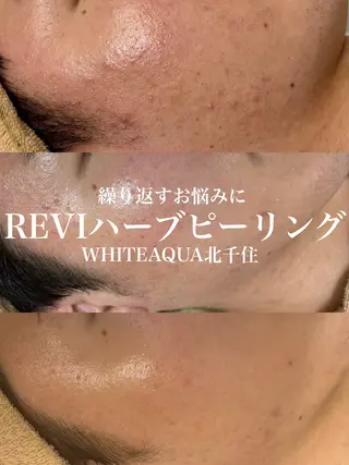 WHITE AQUA 北千住店のエステ・リラクイメージ