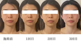 小顔/たるみ/黒ずみ除去専門サロン/SONA 大和西大寺店所属・【小顔専門看護師 サロンSONA】のエステ・リラクイメージ