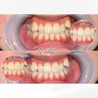 ホワイトニング MIBLANC上野店のその他イメージ