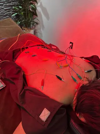 美容鍼灸整体サロンBeauJu所属・小顔矯/美容鍼/鍼灸 BeauJuのその他イメージ