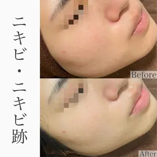 ハーブピーリング専門 BIOEL横浜のエステ・リラクイメージ