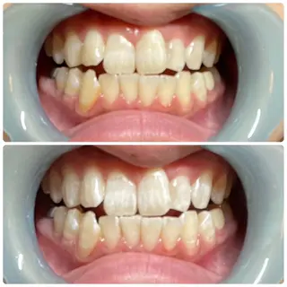 Charme所属・Charme totalsalonのネイルデザイン