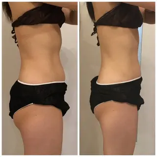 ✨美肌水光✨ アトリエリュバンのエステ・リラクイメージ