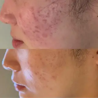 メンズ Blooming所属・LOUISE. ／肌質・頭皮のエステ・リラクイメージ