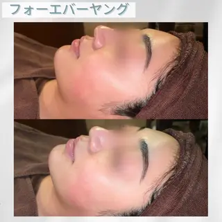 🫧ビュースタ 伊藤🫧のエステ・リラクイメージ