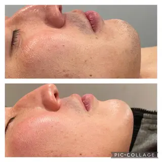 【天神・大名】脱毛/ ハーブ植松७९०のその他イメージ