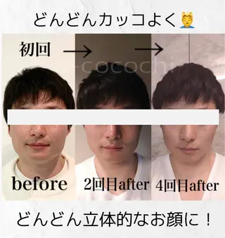 小顔と ヘッドスパのお店のエステ・リラクイメージ