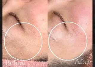 NaKid マツエク&マツパのマツエク・マツパデザイン