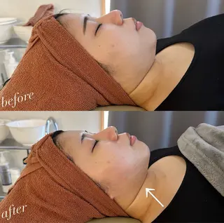 うなじ脱毛/美肌脱毛 LABELのエステ・リラクイメージ