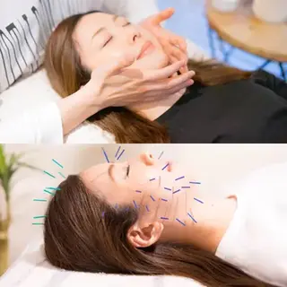 目黒/小顔/骨盤/ 美容鍼/美顔鍼/小林のエステ・リラクイメージ