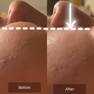 Mandarin Orange所属・毛穴から始める肌メン テマンダリンオレンジのエステ・リラクイメージ