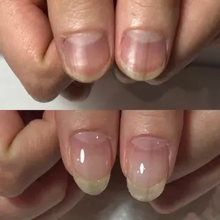 ネイル 自爪育成・巻き爪 補正講師　津蔵のネイルデザイン