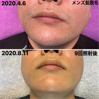 メンズ 脱毛＆エステサロン【アンリミット】所属・森谷 莉美のエステ・リラクイメージ