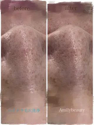 Amilybeauty所属・Amily beauty 毛利のその他イメージ