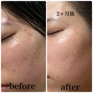 アピタ千代田橋店 POLA THE BEAUTY所属・エステ ツヤ肌 マッサージ POLAのその他イメージ