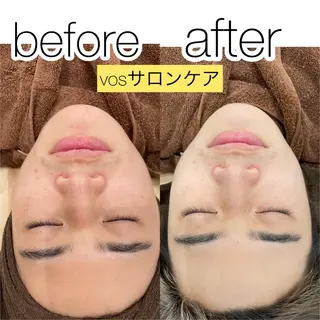 laluna saki...のその他イメージ