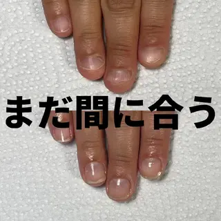 ネイル nail 1623のネイルデザイン