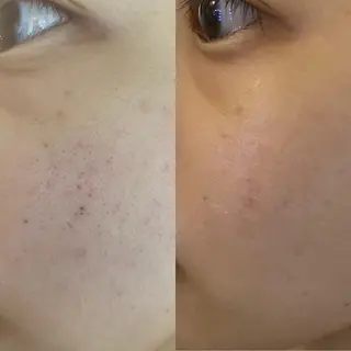 Meetite 小林のエステ・リラクイメージ