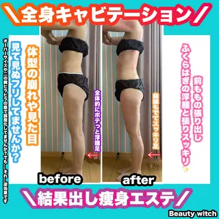 痩身/脱毛/ネイル HARUKAのエステ・リラクイメージ