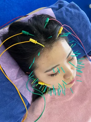 小顔美容鍼専門サロン 渋谷YZのエステ・リラクイメージ