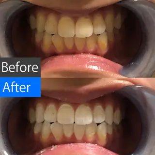 ミディアム カラー キッズ パーマ ネイル ヘアアレンジ マツエク・マツパ メンズ アイブロウ 中目黒 ホワイトニングサロンのその他イメージ