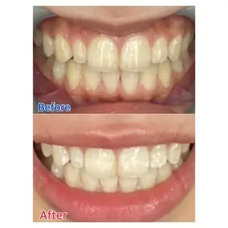 MBEAUTYSALON 千葉店・京成大久保所属・Melty 輝のその他イメージ