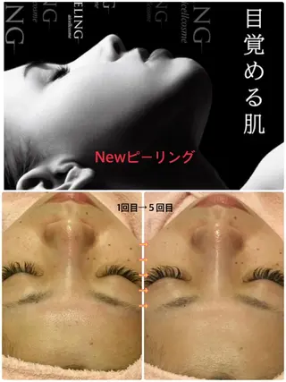 【リベルハーブピーリング認定店】敏感肌・美白脱毛専門店Dione立川店所属・Dione 立川店のエステ・リラクイメージ