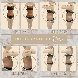 メンズ INDIBA Salon小澤るいのエステ・リラクイメージ
