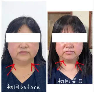 小顔と ヘッドスパのお店のエステ・リラクイメージ