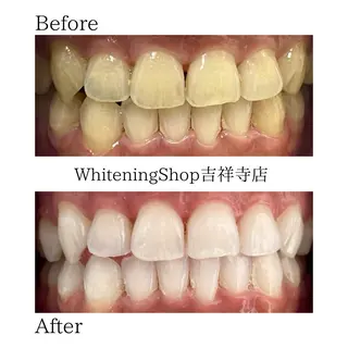 ホワイトニング ショップ吉祥寺店のエステ・リラクイメージ