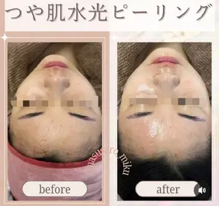 ナスサロ️ 看護師️🫧山口のエステ・リラクイメージ