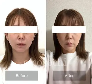 小顔と ヘッドスパのお店のエステ・リラクイメージ